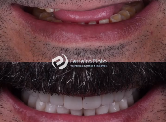 Reabilitação oral TOTAL